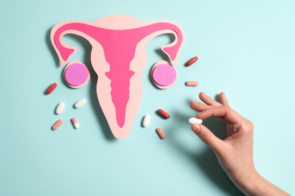 PCOD Diagnosis Illustration