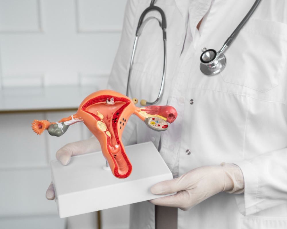 PCOD Treatment Specialist