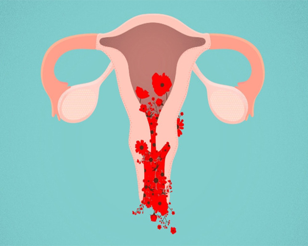 Uterine Tumours